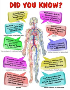A dental poster with the words "did you know?".