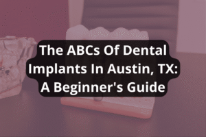 A beginner's guide to dental implants in Austin, Texas by a dentist.