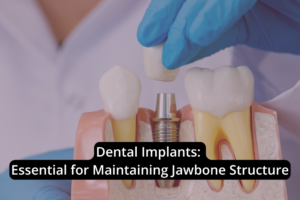 A gloved hand places a dental implant into a model of the jaw, emphasizing the role of dental implants in maintaining jawbone structure.