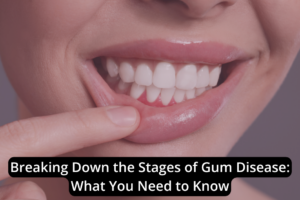 Close-up of a person pulling their lower lip to reveal teeth; text overlay reads "Understanding the Stages: Gum Disease - What You Need to Know.