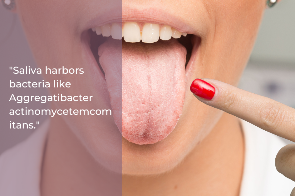A close-up of a person sticking out their tongue with a red-painted nail pointing to it. Text reads: "Saliva harbors bacteria like Aggregatibacter actinomycetemcomitans. Consider a Salivary Bacteria Test for better saliva health.