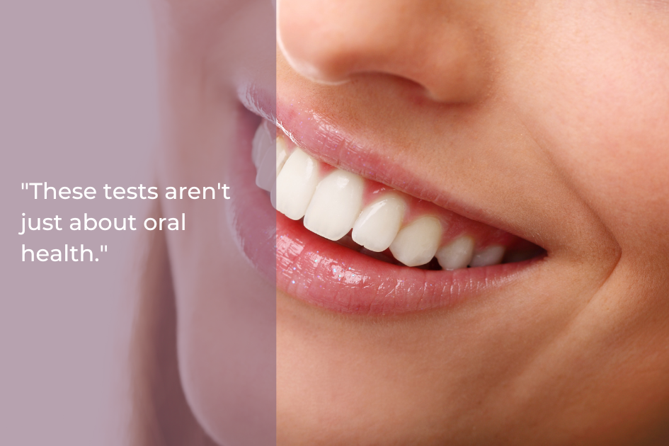 Close-up of a person's smiling mouth showing well-aligned teeth. Text on the left reads, "These tests aren't just about oral health; a salivary bacteria test provides insights into overall well-being.