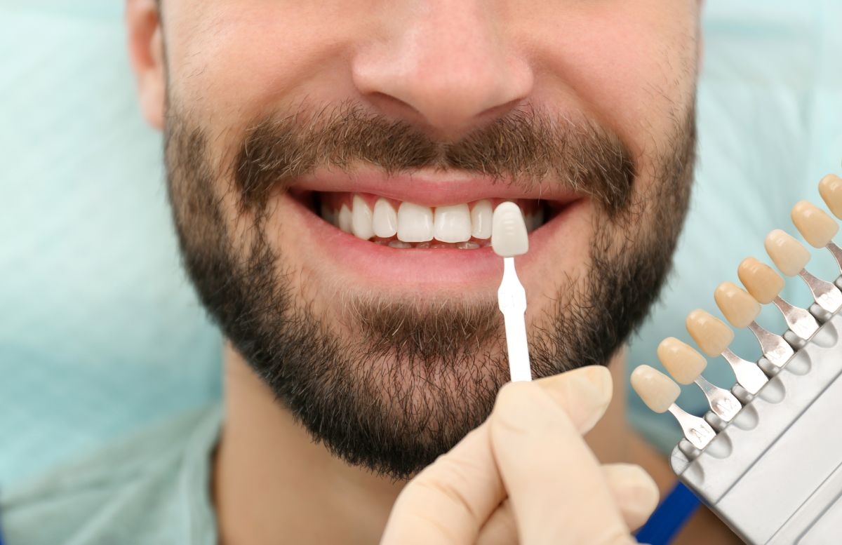 Porcelain veneers in Austin TX - 12 Oaks Integrative Dentistry