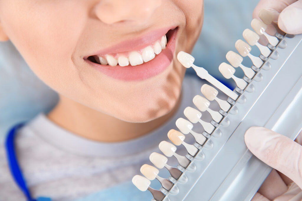 Dentist holds a shade guide next to a smiling patient’s teeth for color matching