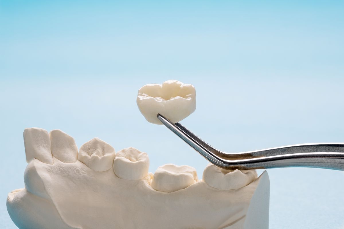 Dental crowns in Austin TX at 12 Oaks Integrative Dentistry
